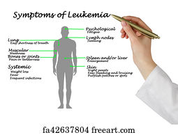 Free art print of Common Symptoms of Leukemia | FreeArt | fa42439393