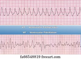 Free Asystole Art Prints and Artworks | FreeArt