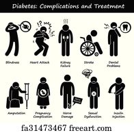 Free art print of Diabetes complications. Diabetes complications ...