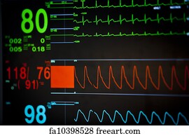 Free Vital Sign Monitor Art Prints And Wall Artwork Freeart