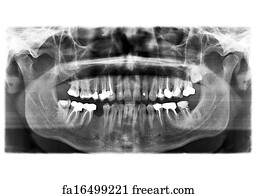Free Teeth Xray Art Prints and Wall Artwork | FreeArt